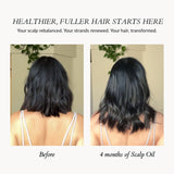 Scalp Oil